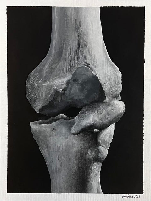 Why Your Knees Feel Older Than You Do