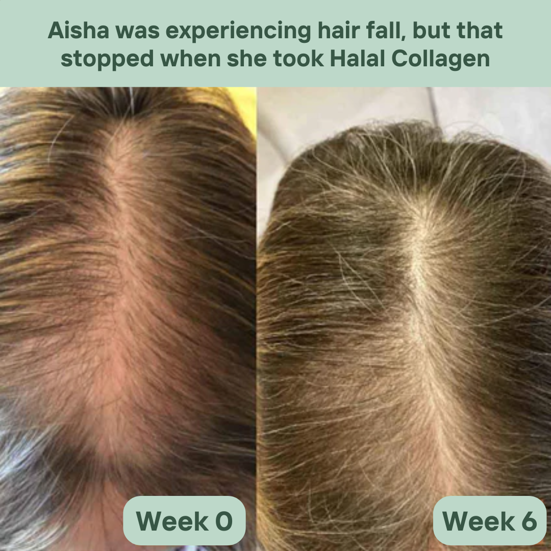Before and After 2