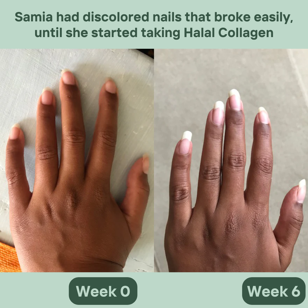 Before and After 3