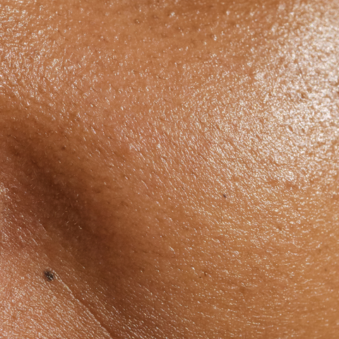 Skin Hydration